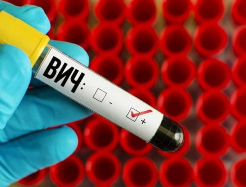 За время пандемии в России ухудшилась диагностика ВИЧ и туберкулёза
