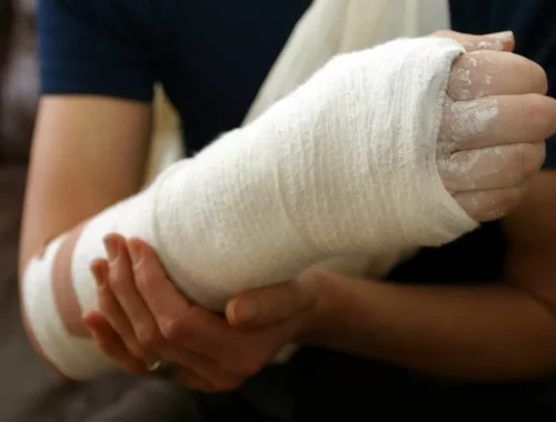 «И так сойдет»: из-за разгильдяйства коммунальщиков жительница Биробиджана вывихнула руку